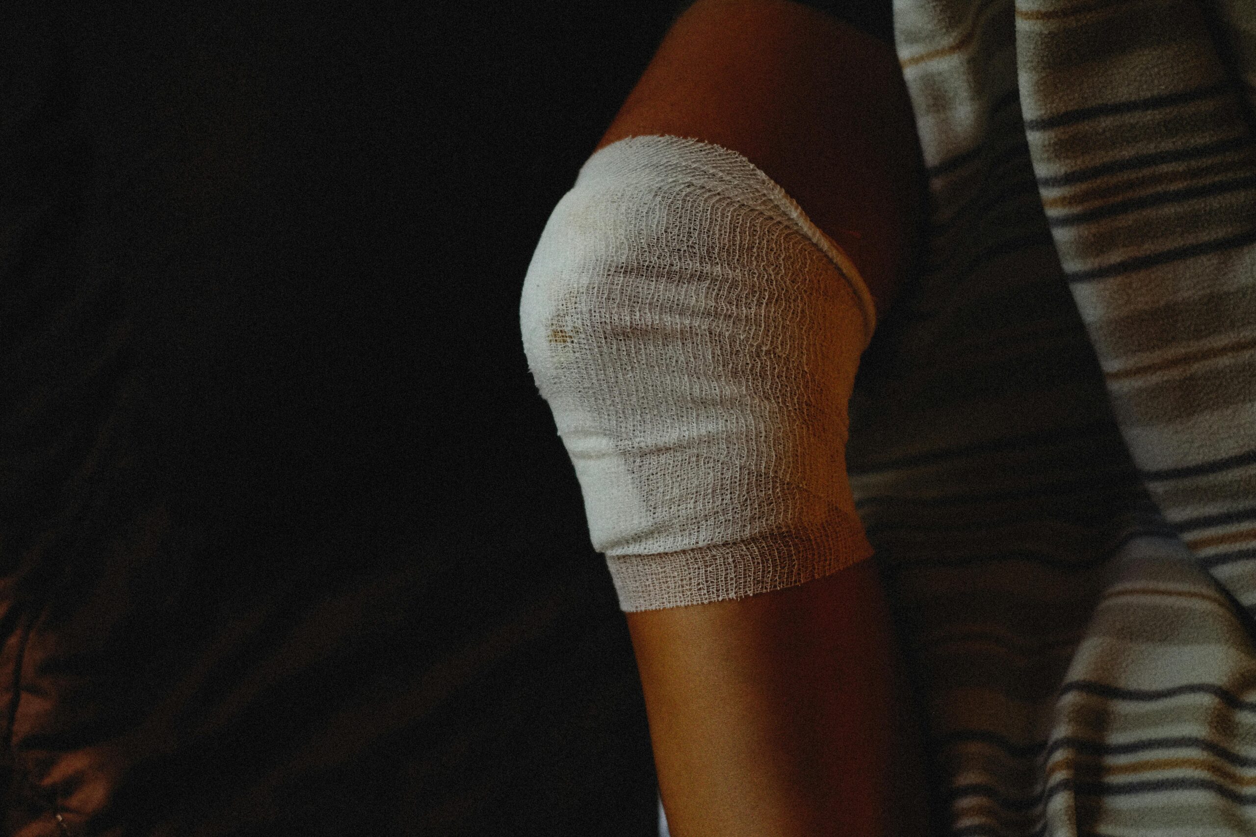 A detailed view of a bandaged knee indicating injury care and healing process.